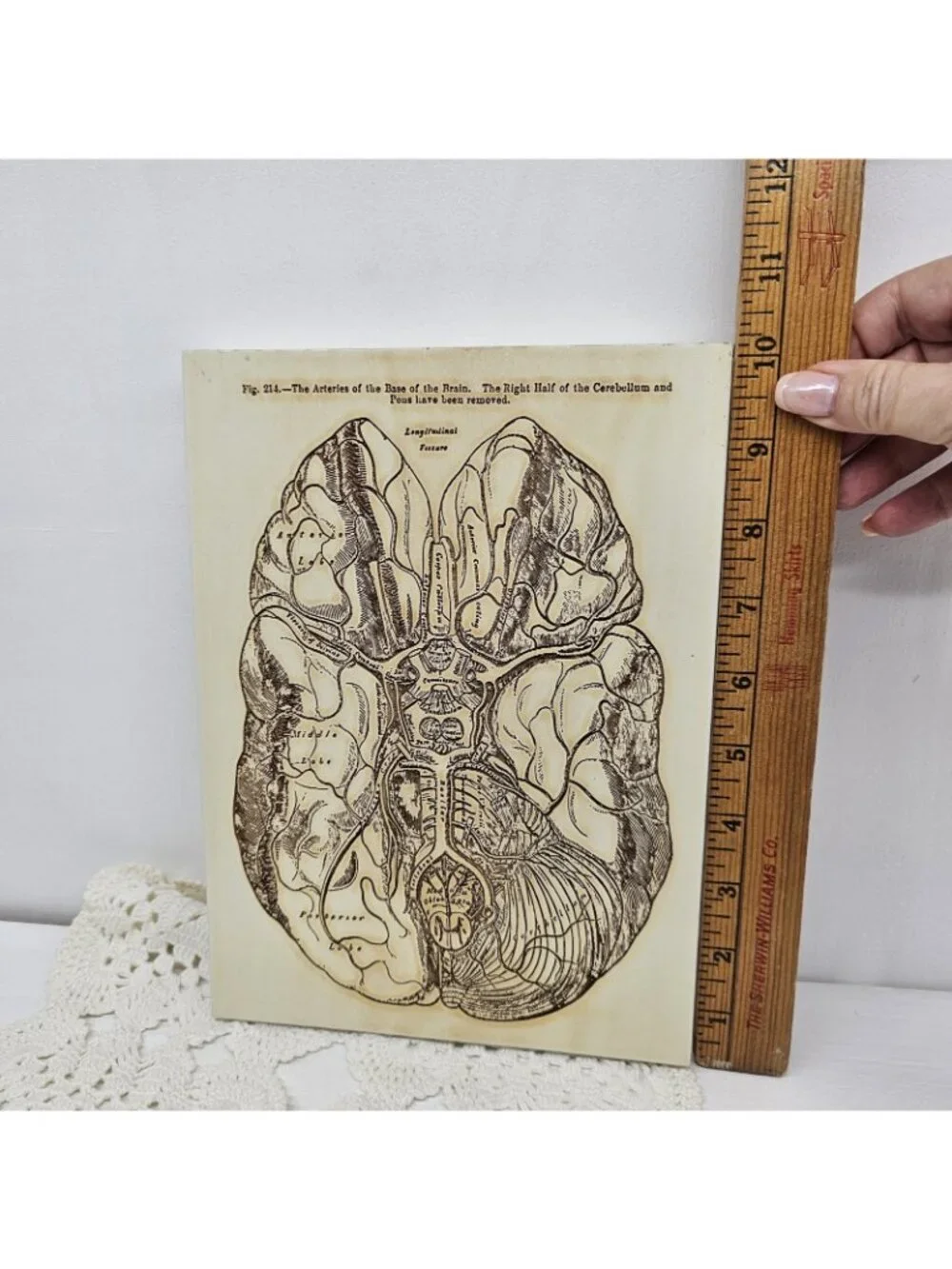 Vintage Gray’s Anatomy Brain Arteries Wood Wall Plaque Medical Art Doctor Gift
